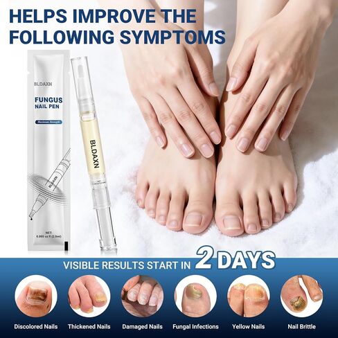 Toenail Fungus Treatment Extra Strength, Fungal Nail Treatment Pen with 25% Undecylenic Acid and 1% Tolnaftate, Maximum Strength Improves Appearance of Brittle, Discolored and Thick Nails (4 Pack) in Saudi Arabia