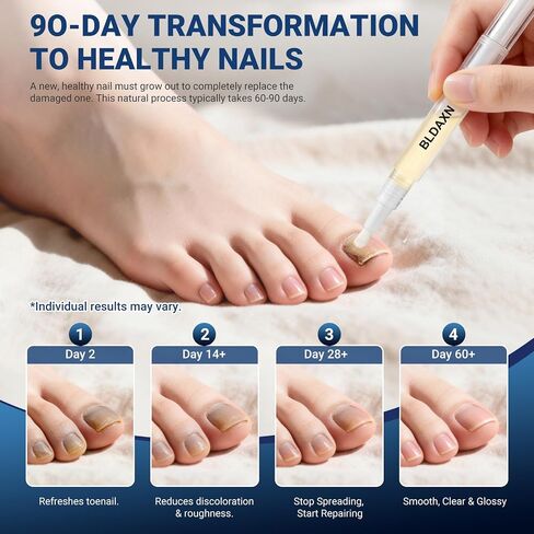 Toenail Fungus Treatment Extra Strength, Fungal Nail Treatment Pen with 25% Undecylenic Acid and 1% Tolnaftate, Maximum Strength Improves Appearance of Brittle, Discolored and Thick Nails (4 Pack) in Saudi Arabia