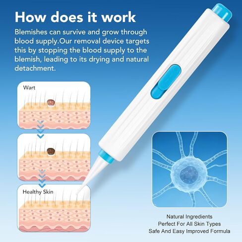 مجموعة إزالة العلامات والثآليل من Capima HM-CRYO، جهاز للاستخدام المنزلي بنقرة واحدة مع أطراف مزدوجة لإزالة علامات الجلد والثآليل-S in Kuwait