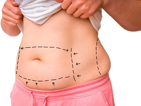Faja de yeso Beauty colombiana, reduce, moldea y define abdomen y cintura. (enviar por mensaje que talla deseas) White in Kuwait