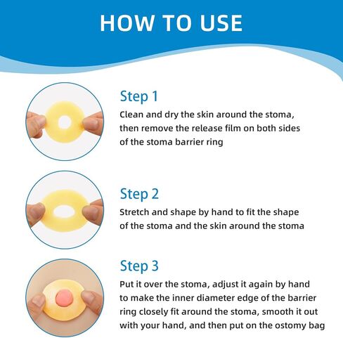Ostomy Barrier Rings, Ostomy Supplies, Moldable Barrier Rings with 2mm Medical Grade Hydrocolloid Better Seal for Ostomy Bag Leak Prevention in Saudi Arabia