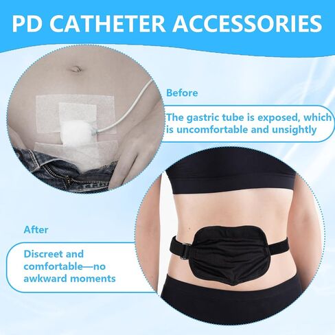 1PCS Peritoneal Dialysis Belt, Adjustable PD Catheter Holder, Feeding Tube Holder for Peg Tube, J-Tube, G Tube Accessories, Dialysis Patients for Sports and Nursing Supplies(Black) in Saudi Arabia