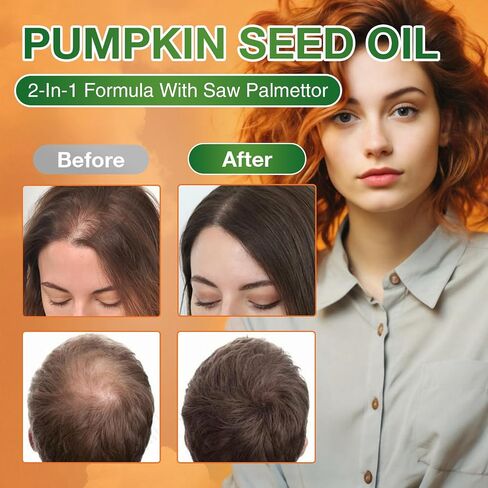 Pumpkin Seed Oil Capsules - Saw Palmetto Pumpkin Seed Oil 300 Softgels 3000mg for Prostate Health, Immune and Urinary Tract Support Promotes Hair Growth - Pure Non GMO in Saudi Arabia