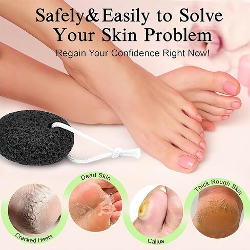 Natural Lava Pumice Stone 2-Pack, Black & White Volcanic Foot Scrubber - Professional Callus Remover for Dead Skin & Hard Skin on Feet and Heels, Pedicure Exfoliator Tool in Kuwait