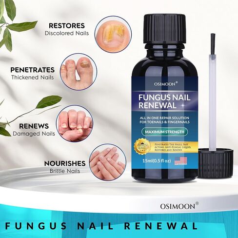 OSIMOON Toenail Fungus Treatment with Undecylenic Acid 10% – Toe Nail Care Solution for Thick & Discolored Nails, Daily Nail Repair Serum for Men & Women (30ml, Ginger) in Saudi Arabia