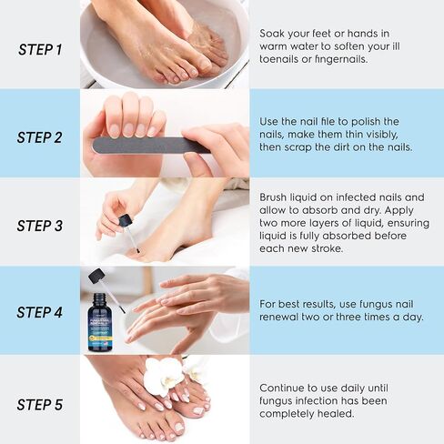 OSIMOON Toenail Fungus Treatment with Undecylenic Acid 10% – Toe Nail Care Solution for Thick & Discolored Nails, Daily Nail Repair Serum for Men & Women (30ml, Ginger) in Saudi Arabia