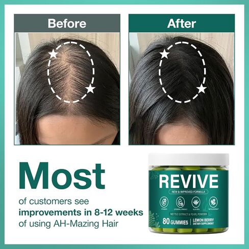 Revive Hair Gummies,Sea Moss Gummies with Vitamin C, Vitamin E, Aloe Vera, Pearl Powder Supports Faster Hair Growth, Stronger Nails&Healthy Skin,80 Count in Saudi Arabia