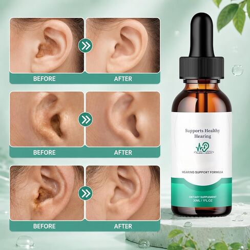 2PCS Tinnitus Relief Ear Drops, Earwax Removal & Ear Cleaning Solution, Ear Hygiene Liquid in Kuwait