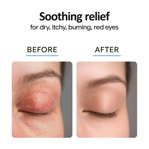 Eyelid Cleanser Spray 8oz | Blepharitis Treatment | Stye Eye Treatment | Eyelid Cleanser for Demodex, Chalazion, MGD, Mites, Dry Eye Relief | Hypochlorous Acid Spray For Eyes | Lid and Eyelash Cleaner in Kuwait