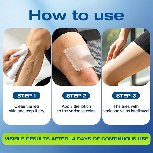 Vein Ease Microdarts Care Patches 2 Hours Fast Acting Leg Vein Care Patch Soothe Leg Swelling & Fatigue Improve Blood Circulation Varicose Veins Relief Patch for All Men Women All Skin Types in Saudi Arabia