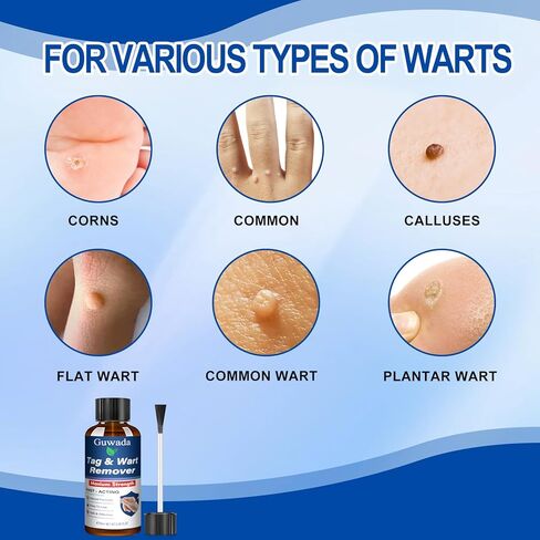 Skin Tag&Wart Appearance Gel -12% salicylic acid - Fast-acting, precisely applied to the feet and common warts, clinically effective,Wart Removal Freeze Away,maximum strength for men and women-1A1A in Saudi Arabia