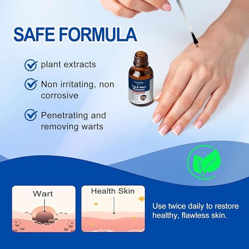 Skin Tag&Wart Appearance Gel -12% salicylic acid - Fast-acting, precisely applied to the feet and common warts, clinically effective,Wart Removal Freeze Away,maximum strength for men and women-1A1A in Saudi Arabia