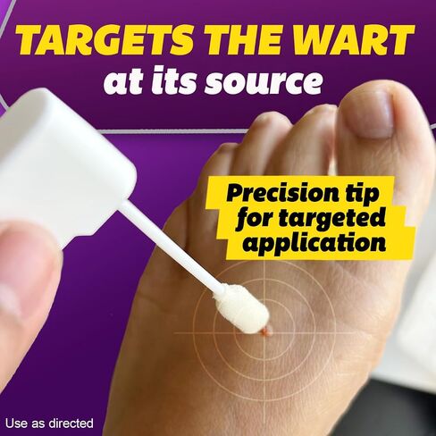 Silka Pointts Wart Remover Freeze Off, At-Home Cryotherapy Freezer for Common and Plantar Warts on Hands and Feet, Designed for Safe and Easy Wart Removal with 12 Precision Applicators in Saudi Arabia