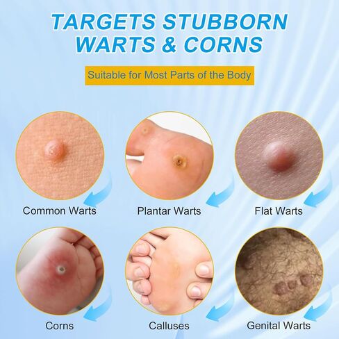 WART Corn Remover Pads for Feet 40% Salicylic Acid Wart Remover Pads, WART Corn Removers for Toes,Body（NDC Code: 85248-065-01） in Kuwait