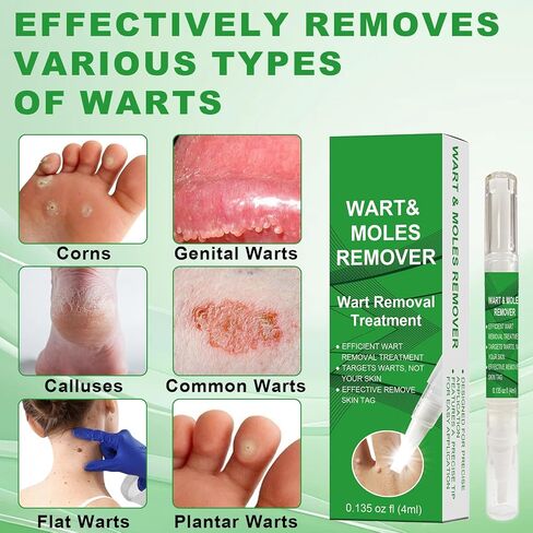 Fast Acting Skin Tag Remover for Face & Body I Salicylic Acid Wart Remover Pen with Brush I Gentle Formula, Travel Size (0.135FL.OZ) in Saudi Arabia