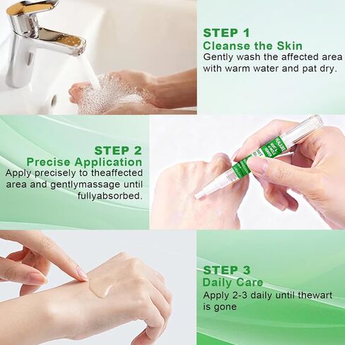 Fast Acting Skin Tag Remover for Face & Body I Salicylic Acid Wart Remover Pen with Brush I Gentle Formula, Travel Size (0.135FL.OZ) in Saudi Arabia