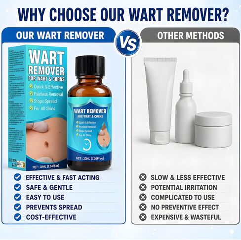 Bee Venom Wart Remover Liquid, Fast Acting Salicylic Acid Treatment for Plantar Warts, Corns & Calluses, Gentle Maximum Strength Formula for Feet, Toes & Hands, 30ML in Saudi Arabia