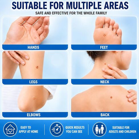 Bee Venom Wart Remover Liquid, Fast Acting Salicylic Acid Treatment for Plantar Warts, Corns & Calluses, Gentle Maximum Strength Formula for Feet, Toes & Hands, 30ML in Saudi Arabia