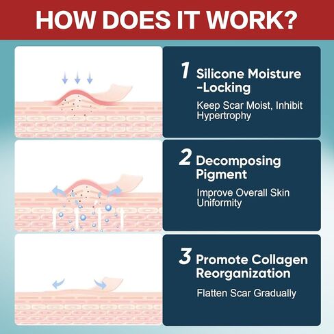 Silicone Scar Tape (1.6"x240"-6M),Silicone Scar Sheets for Scar Removal Treatment,Silicone Scar Removal Strips for Surgical,C-Section,Tummy Tuck,Keloid Scars in Kuwait