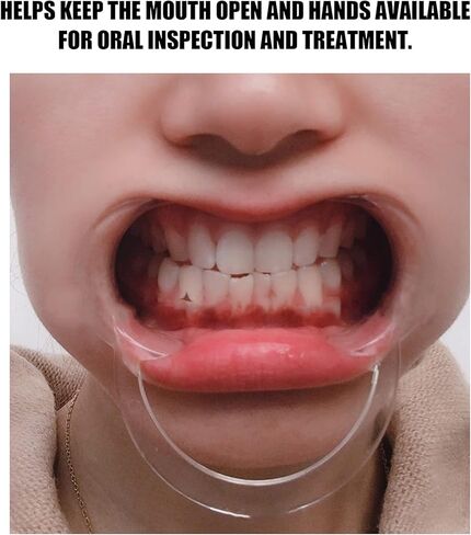 20pcs Disposable Lip Cheek Retractor, C-Shape Teeth Whitening Cheek Retractor for Mouthguard Challenge Game,Transparent C‑Shape Teeth Whitening Mouth Opener, (Transparent Medium) in Saudi Arabia