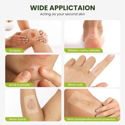 Bukihome Hydrocolloid Roll Gel Bandages Patch with Self-Adhesive - Thickened Tape for Blister, Burn, Acne Care - Cut-to-Size, Ultra Absorbent, First Aid Essential - Infused Tea Tree Oil(2.56in*16.4ft) in Kuwait