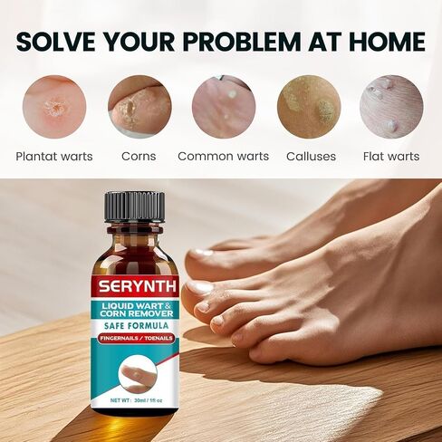 Wart Remover Liquid Maximum Strength - 17% Salicylic Acid, Fast-Acting, Effective & Painless Wart Removal for Plantar, Common & Flat Warts, Most Body Warts 30ML in Saudi Arabia