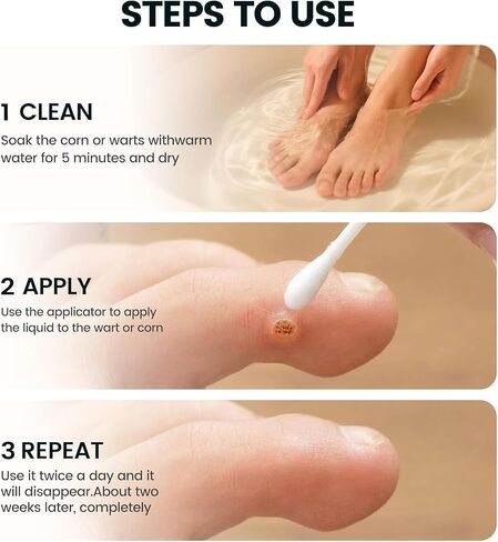 Wart Remover Liquid Maximum Strength - 17% Salicylic Acid, Fast-Acting, Effective & Painless Wart Removal for Plantar, Common & Flat Warts, Most Body Warts 30ML in Saudi Arabia