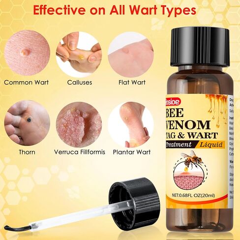 TAG&WART Remover, Bee Venom Salicylic Acid Freeze Wart Treatment – Fast-Acting Skin Tag & Plantar Wart Remover for Men and Women – Treats Corns, Calluses, Flat & Common Warts in Saudi Arabia
