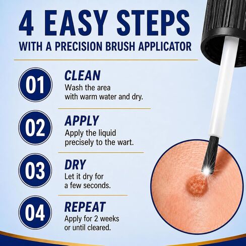 DVO Wart Remover, 20% Salicylic Acid Wart Remover Liquid – Fast Acting Wart Treatment with Precision Brush Applicator, Wart Remover for Hands, Feet & Body 15ml in Saudi Arabia