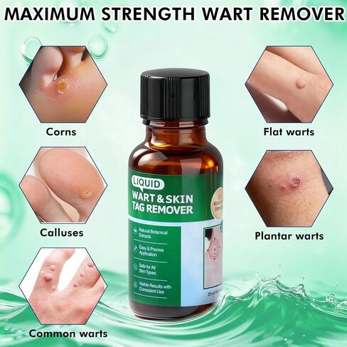 Wart Remover with 15% Salicylic Acid, Maximum Strength Skin Tag Remover for Common and Plantar Warts, Corns & Calluses, Fast-Acting Skin Tag Removal for Men and Women in Kuwait