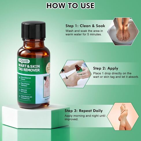 Wart Remover with 15% Salicylic Acid, Maximum Strength Skin Tag Remover for Common and Plantar Warts, Corns & Calluses, Fast-Acting Skin Tag Removal for Men and Women in Kuwait