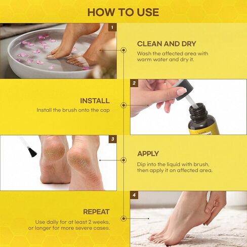 SupreH Fast-Acting Bee Venom Wart Skin Tag Remover for Men and Women 20 M in Kuwait