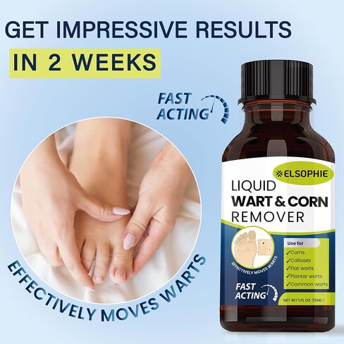 Fast-Acting Wart Remover Freeze Off with Salicylic Acid Maximum Strength for Men and Women - Plantar Wart Genital Wart Corns Calluses 1 oz in Saudi Arabia