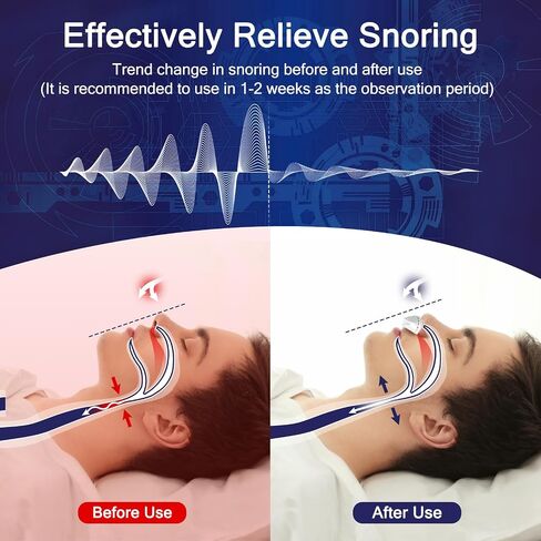 Micro Anti Snoring Devices, Electric Snoring Solution, Adjustable Wind Speed Anti Snore Device Aids for Men & Women Travel,White in Saudi Arabia