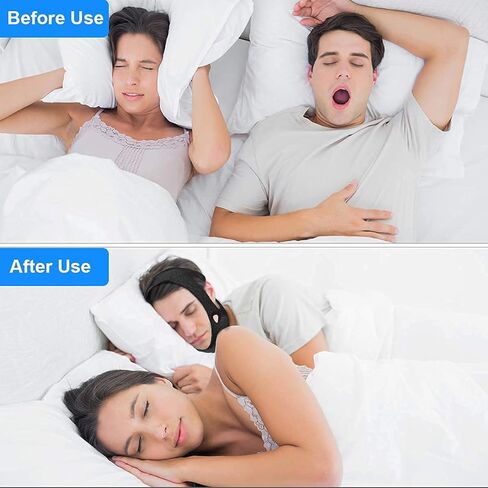Snoring Chin Strap - Anti Snore Chin Strap for Men/Women, Adjustable Snoring Chin Strap for Cpap Users - TF06 in Saudi Arabia