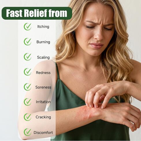 Antifungal Cream with Tea Tree Oil - Advanced Herbal Relief for Skin Fungus, Athlete's Foot, Jock Itch, Eczema, Tinea Versicolor, Natural Treatment, Relieves Itching, Burning, Scaling - 100g in Saudi Arabia