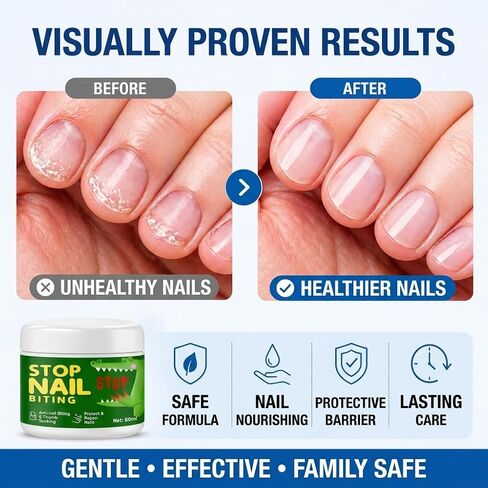 Nail Biting Treatment for Kids and Adults, Stop Nail Biting and Thumb Sucking Deterrent, Bitter Taste Liquid for Fingernail Care, Support Healthy Growth Habits, Clear Finish, 60 ml in Kuwait