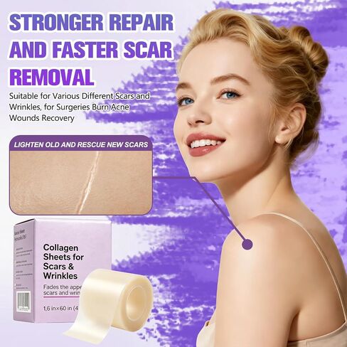 Collagen Tape, Collagen Sheets for Scars & Wrinkle, Silicone Scar Removal Strips for Various Different Scars and Wrinkles, for Surgeries Burn Acne Wounds Recovery in Saudi Arabia