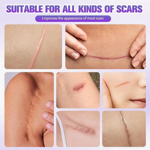 Collagen Tape, Collagen Sheets for Scars & Wrinkle, Silicone Scar Removal Strips for Various Different Scars and Wrinkles, for Surgeries Burn Acne Wounds Recovery in Saudi Arabia