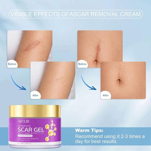 Scar Cream,Silicone Scar Gel,Helps Reduce Surgical Scars,Acne,Burn,Keloids Bump,Stretch Marks, Advanced Scar Removal Cream for Old and New Scars(1.69oz) in Saudi Arabia
