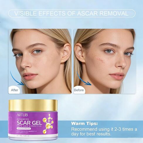 Scar Cream,Silicone Scar Gel,Helps Reduce Surgical Scars,Acne,Burn,Keloids Bump,Stretch Marks, Advanced Scar Removal Cream for Old and New Scars(1.69oz) in Saudi Arabia