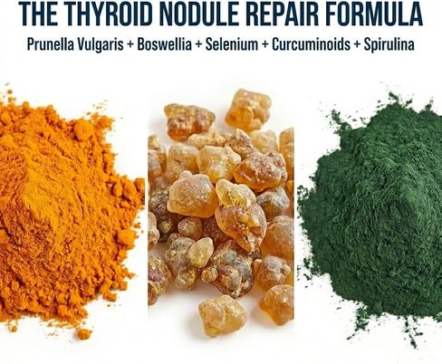Dr. Westin Childs Thyroid Nodule Support Supplement for Gland Size, Health & Control in Women & Men: Boswellia, Turmeric, Myo-Inositol, Selenium, Prunella Vulgaris 120 ct in Saudi Arabia