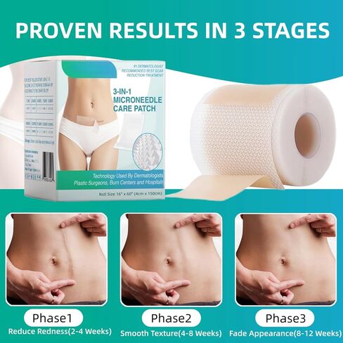 Lonqi Care Breeze 3 in 1 Care Patch, 2026 New Hyaluronic Acid Nano Repair Silicone Sheets, Waterproof Reusable Scar Tape for Wrinkles & Scars, Fits All Skin Types（2 Box） in Saudi Arabia