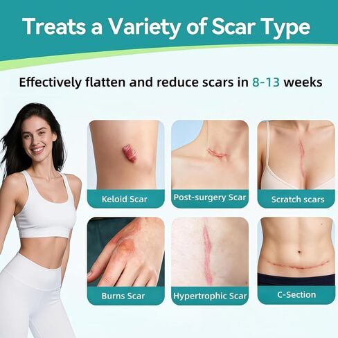 Lonqi Care Breeze 3 in 1 Care Patch, 2026 New Hyaluronic Acid Nano Repair Silicone Sheets, Waterproof Reusable Scar Tape for Wrinkles & Scars, Fits All Skin Types（2 Box） in Saudi Arabia