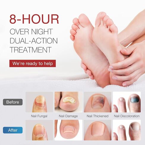 Toenail Fungus Treatment Extra Strength - DR.RAPID Toenail Fungus Treatment Pen & Fungal Nail Patches, Day and Night Fungal Nail Treatment Set, Ideal for Nail Repair for Damaged Nails Toenail Fungus in Kuwait