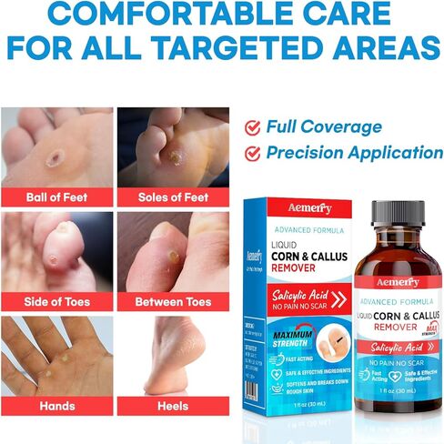 Aemerry Corn Removers for Toes Foot: Liquid Salicylic Acid 17% Corns Calluses Removal Extra Strength, Fast Acting Corn Remover for Feet Fingers. 30ml in Kuwait