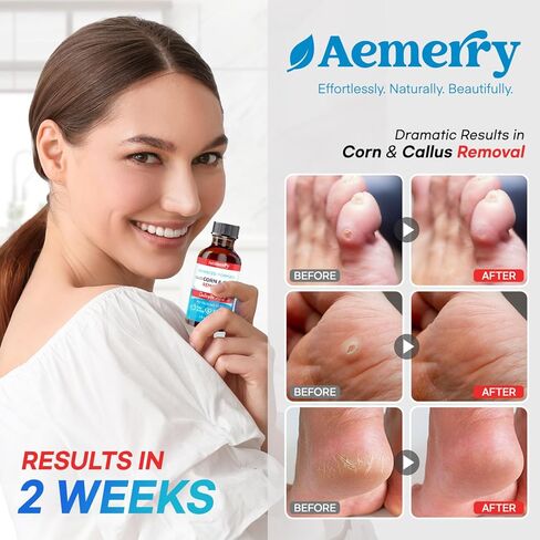 Aemerry Corn Removers for Toes Foot: Liquid Salicylic Acid 17% Corns Calluses Removal Extra Strength, Fast Acting Corn Remover for Feet Fingers. 30ml in Kuwait