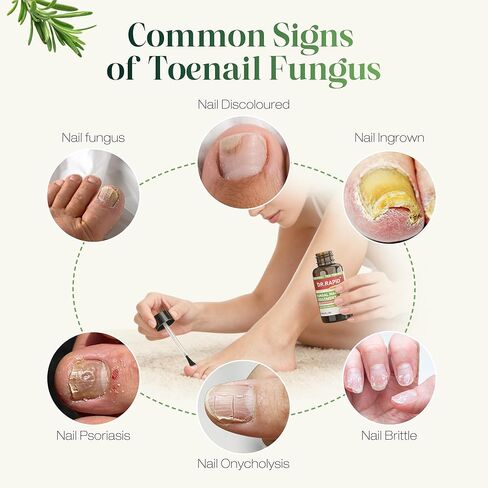 Toenail Fungus Treatment Extra Strength - DR.RAPID Nail Repair for Damaged Nails, Nail Fungus Treatment Extra Strength with 25% Undecylenic Acid & Tea Tree Oil, Nail Repair for nail fungus treatment in Saudi Arabia