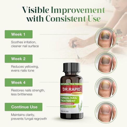 Toenail Fungus Treatment Extra Strength - DR.RAPID Nail Repair for Damaged Nails, Nail Fungus Treatment Extra Strength with 25% Undecylenic Acid & Tea Tree Oil, Nail Repair for nail fungus treatment in Saudi Arabia