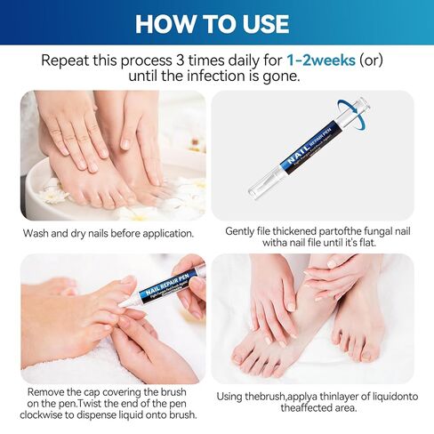 Nail Fungus Treatment Pen (5 Count) 25% Undecylenic Acid Maximum Strength Toenail Fungus Pen, Suitable for Toenail Repair for Damaged, Broken& Discolored Nails Repair -5ml/0.18FLOZ in Kuwait